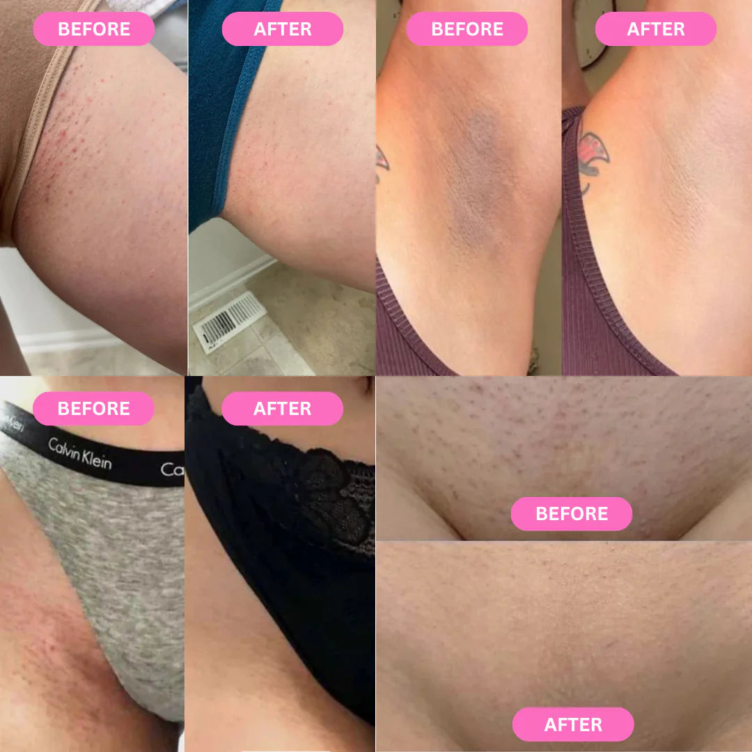 SmoothShave™ Razor